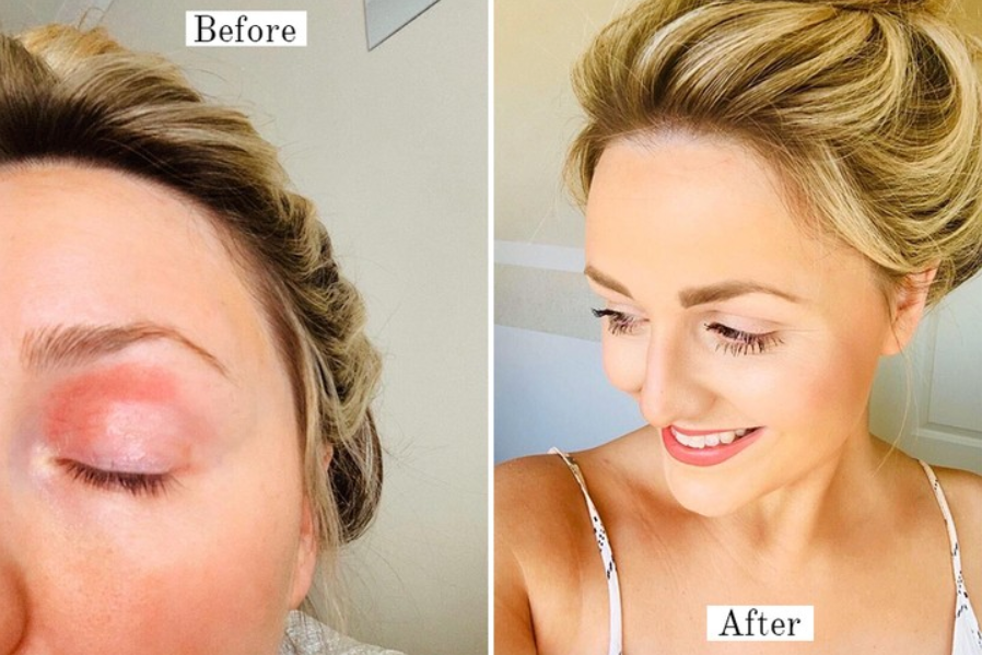 Bee Calm Hudlindrande Salva